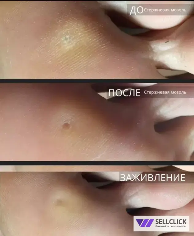 ПОДОЛОГ И ЭСТЕТИЧЕСКИЙ ПЕДИКЮР