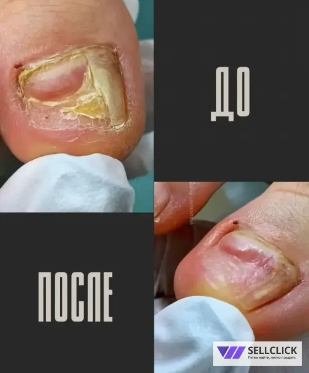 ПОДОЛОГ И ЭСТЕТИЧЕСКИЙ ПЕДИКЮР