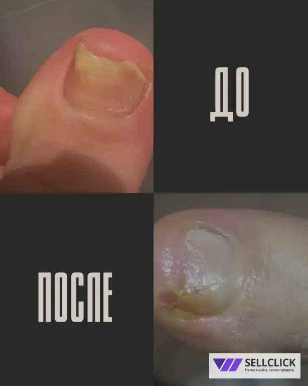 ПОДОЛОГ И ЭСТЕТИЧЕСКИЙ ПЕДИКЮР