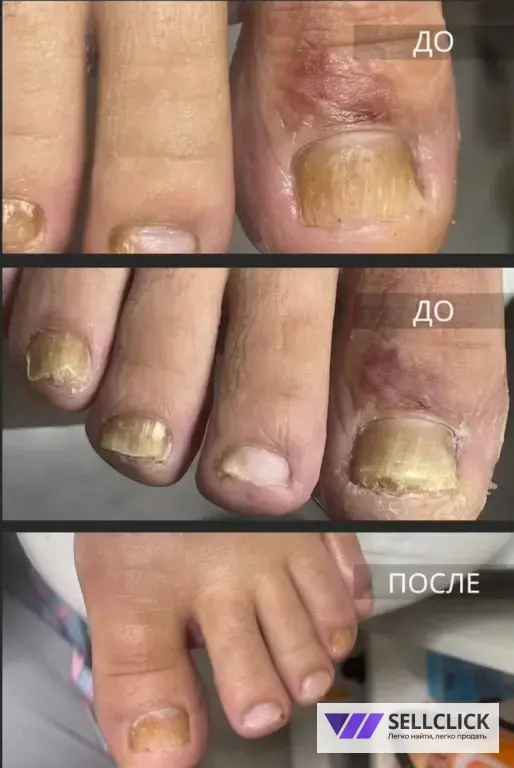 ПОДОЛОГ И ЭСТЕТИЧЕСКИЙ ПЕДИКЮР