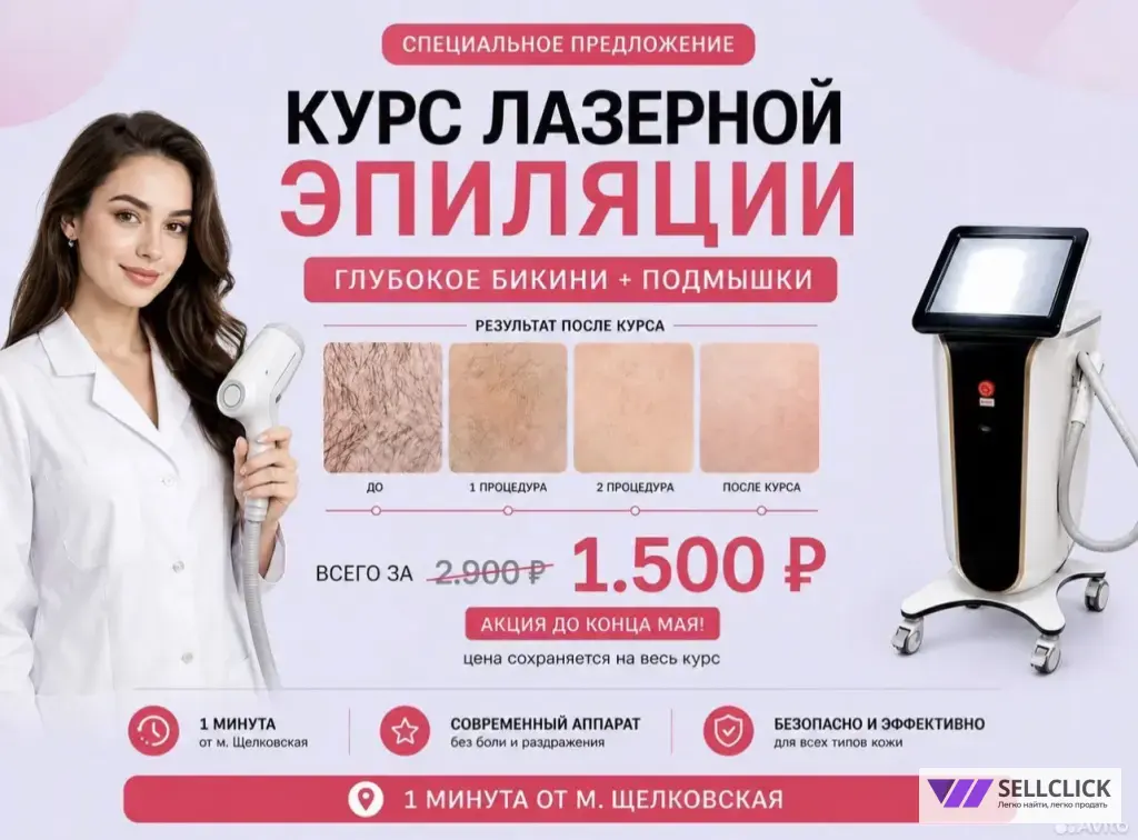 лазерная эпиляция
