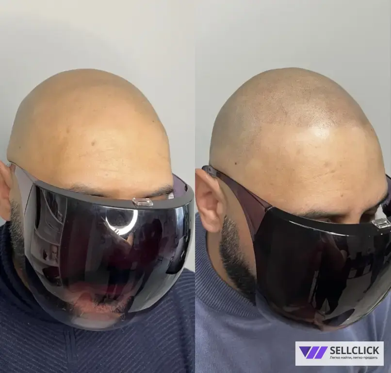 МИКРОПИГМЕНТАЦИЯ