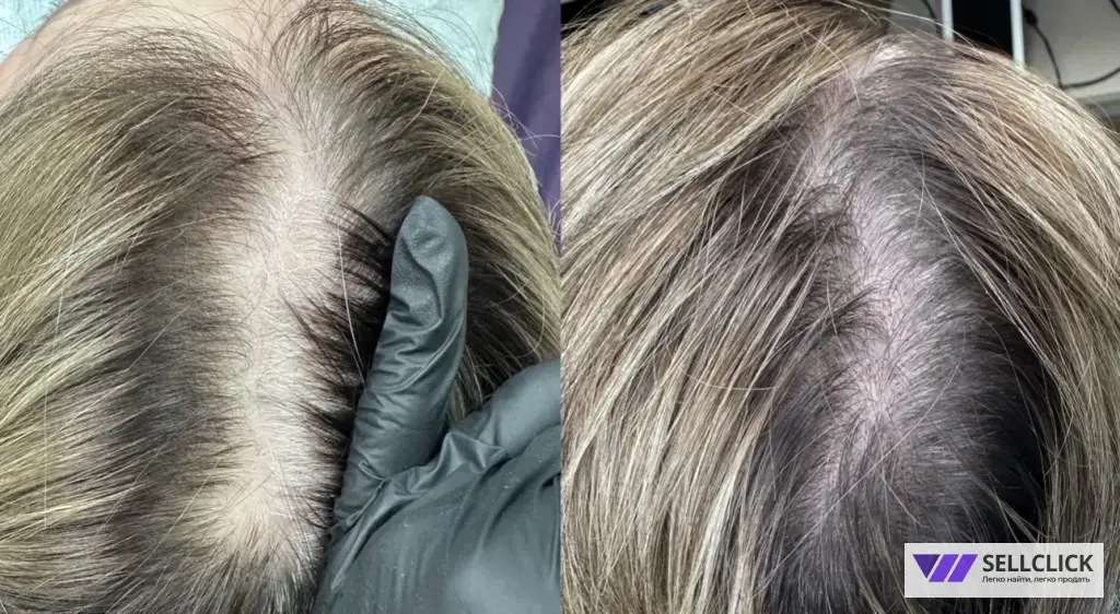 МИКРОПИГМЕНТАЦИЯ