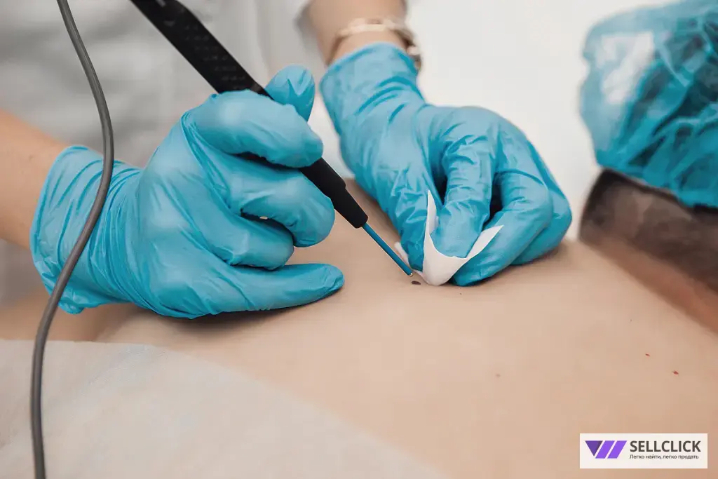 удаление новообразований