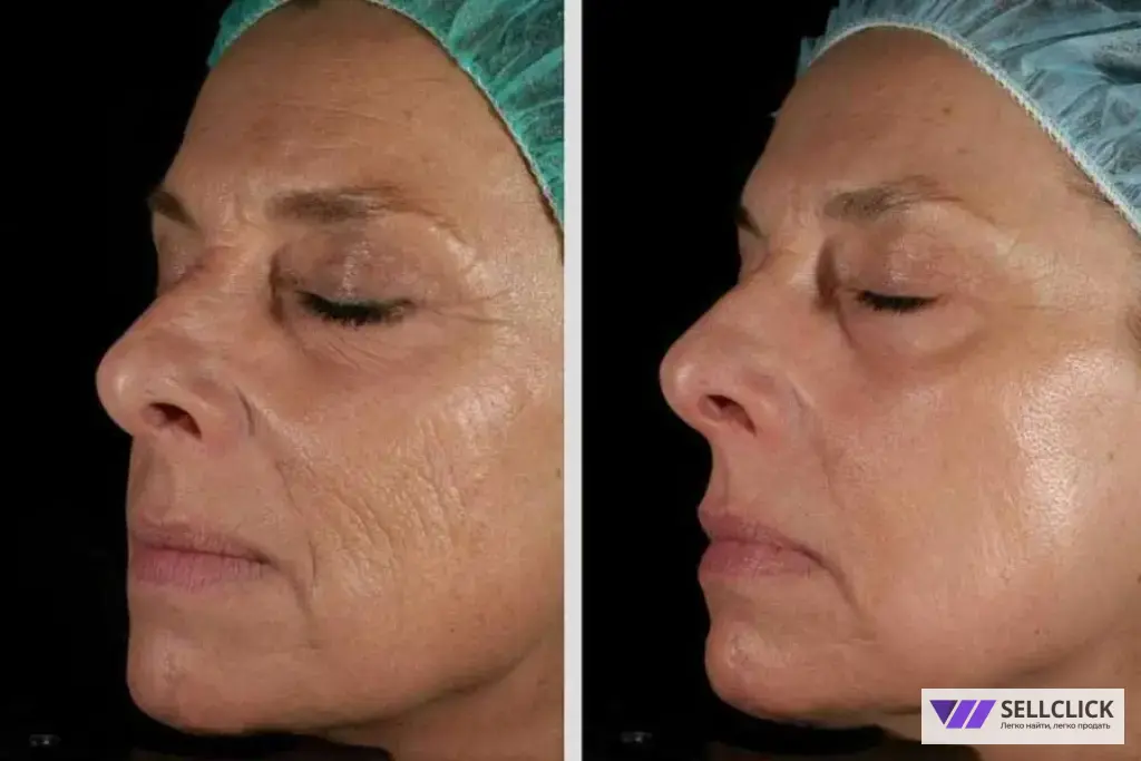 косметолог ,чистка лица