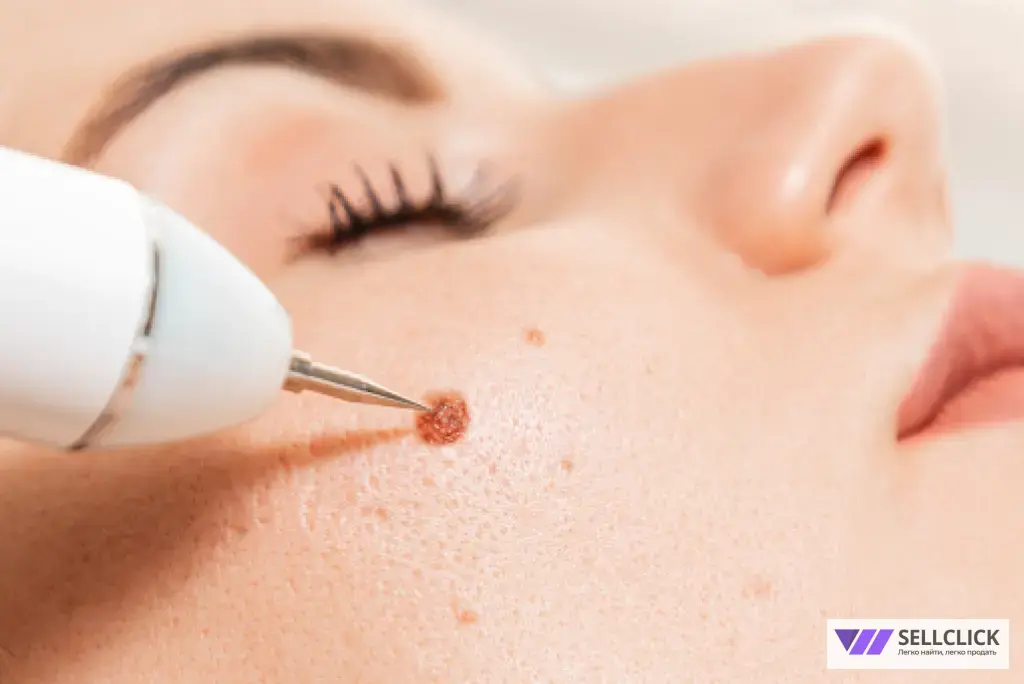 удаление новообразований