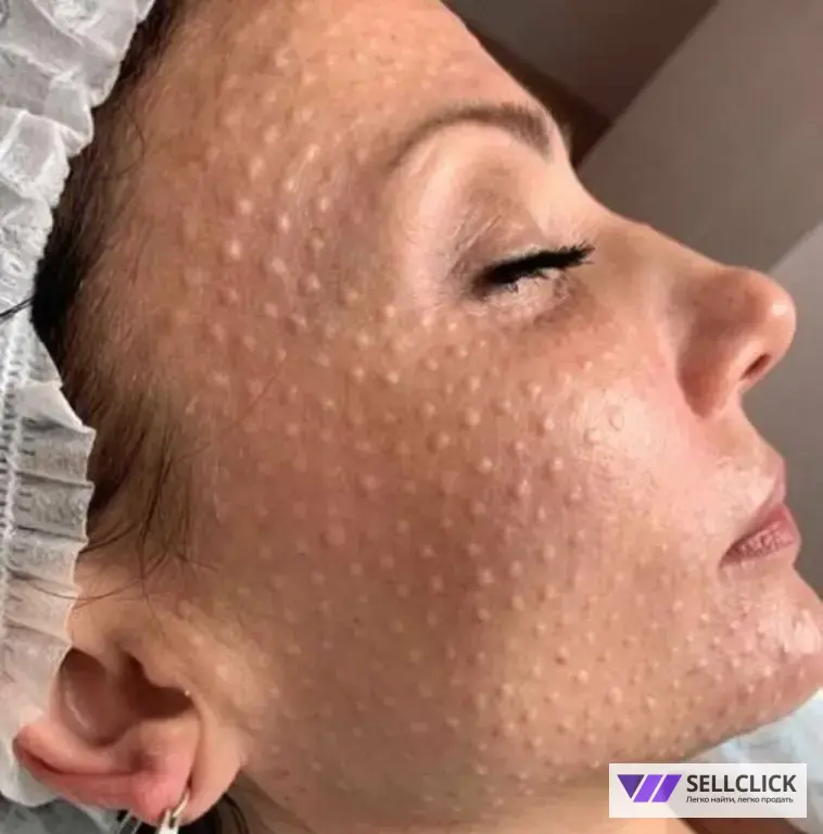 косметолог ,чистка лица