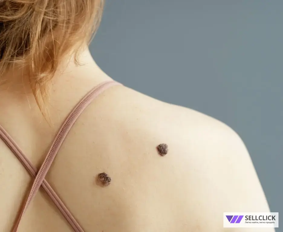 удаление новообразований