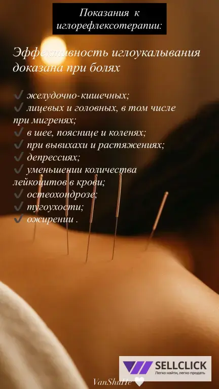 Иглоукалывание !